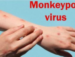 Pria asal Jakarta Positif Terpapar Virus Cacar Monyet, Kemenkes Siapkan 10 Ribu Dosis Vaksin